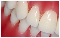 periodontoloji
